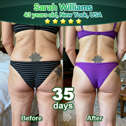 1𝑳𝒐𝒕𝑚𝑎𝑦® 𝑺𝑡𝑒𝑚 𝑪𝑒𝑙𝑙 & 𝑪𝑜𝑙𝑙𝑎𝑔𝑒𝑛 𝑷𝑒𝑝𝑡𝑖𝑑𝑒 𝑶𝑟𝑎𝑙 𝑫𝑟𝑜𝑝𝑠 (𝑳𝑖𝑓𝑡 & 𝑭𝑖𝑟𝑚 𝑺𝑎𝑔𝑔𝑖𝑛𝑔 𝑺𝑘𝑖𝑛 & 𝑹𝑒𝑑𝑢𝑐𝑒 𝑾𝑟𝑖𝑛𝑘𝑙𝑒 𝑭𝑜𝑟𝑚𝑎𝑡𝑖𝑜𝑛) 💎