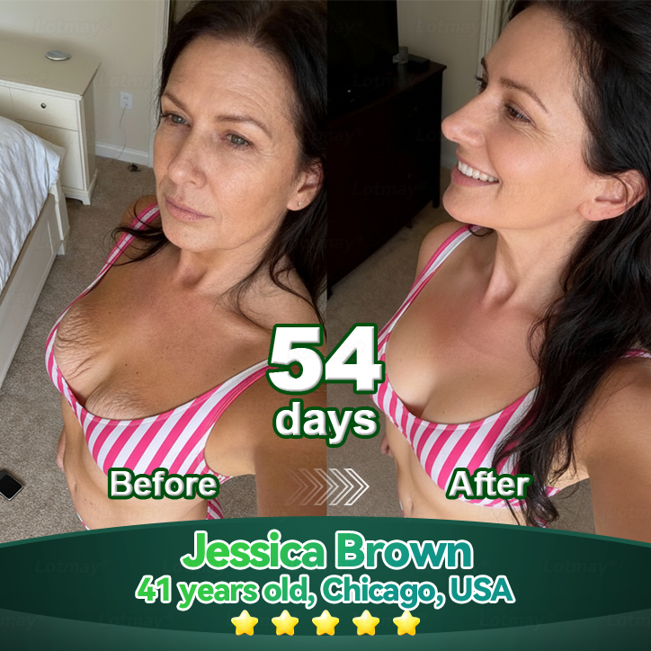 𝑳𝒐𝒕𝑚𝑎𝑦® 𝑺𝑡𝑒𝑚 𝑪𝑒𝑙𝑙 & 𝑪𝑜𝑙𝑙𝑎𝑔𝑒𝑛 𝑷𝑒𝑝𝑡𝑖𝑑𝑒 𝑶𝑟𝑎𝑙 𝑫𝑟𝑜𝑝𝑠 (𝑳𝑖𝑓𝑡 & 𝑭𝑖𝑟𝑚 𝑺𝑎𝑔𝑔𝑖𝑛𝑔 𝑺𝑘𝑖𝑛 & 𝑹𝑒𝑑𝑢𝑐𝑒 𝑾𝑟𝑖𝑛𝑘𝑙𝑒 𝑭𝑜𝑟𝑚𝑎𝑡𝑖𝑜𝑛) 💎